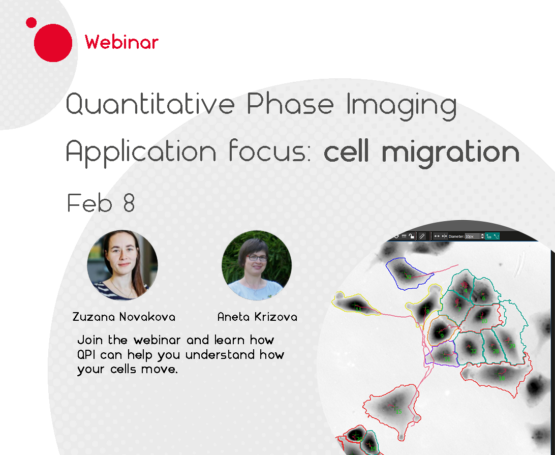 Webinar: Quantitative Phase Imaging and cell migration
