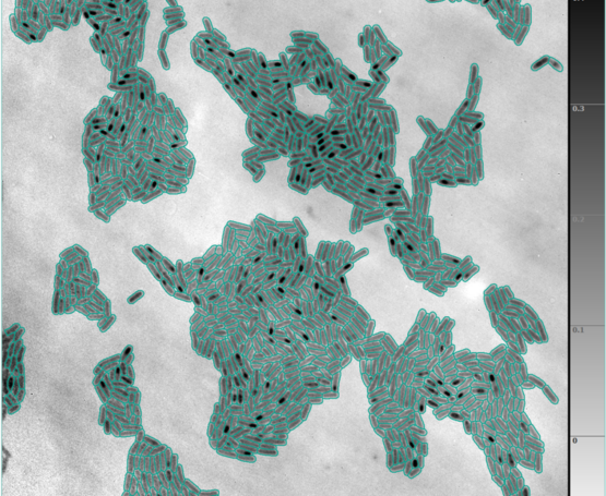 Introducing advanced AI-assisted cell segmentation in Q-Phase
